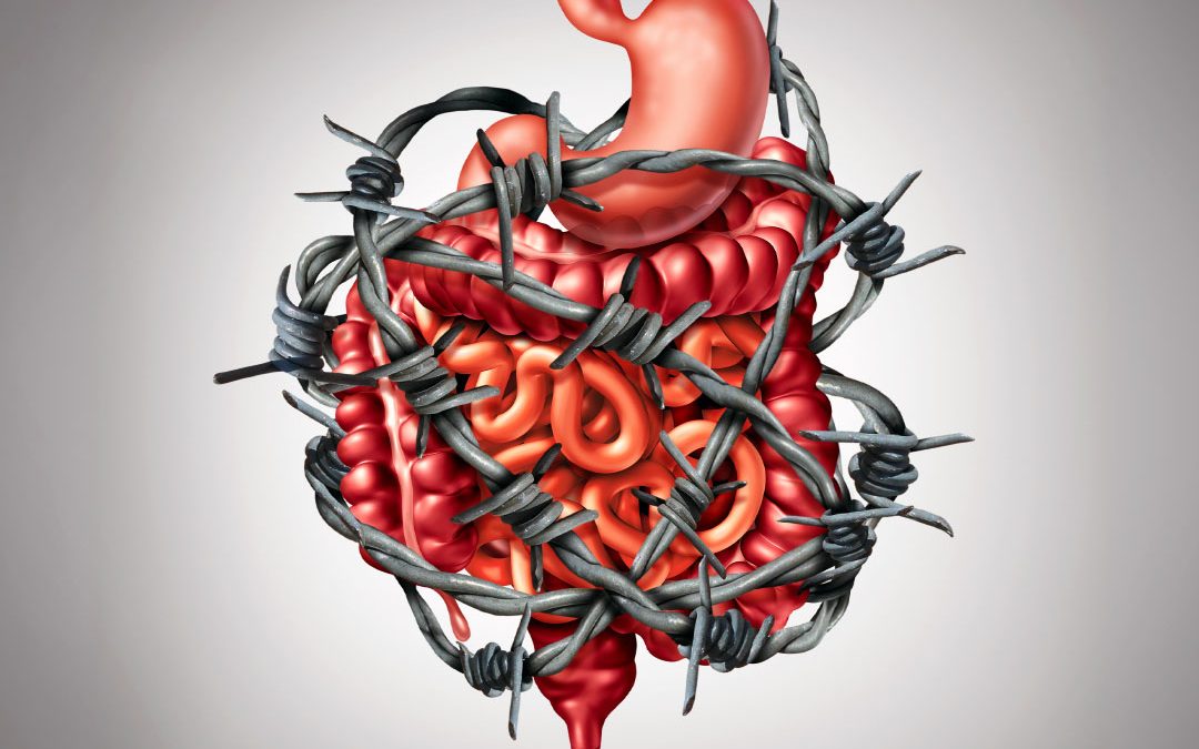 Illustration of a GI tract wrapped in barbed wire representing digestive pain